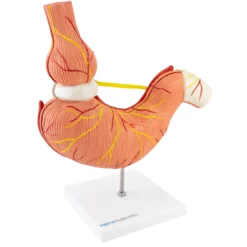 Modell Magen mit Magenband