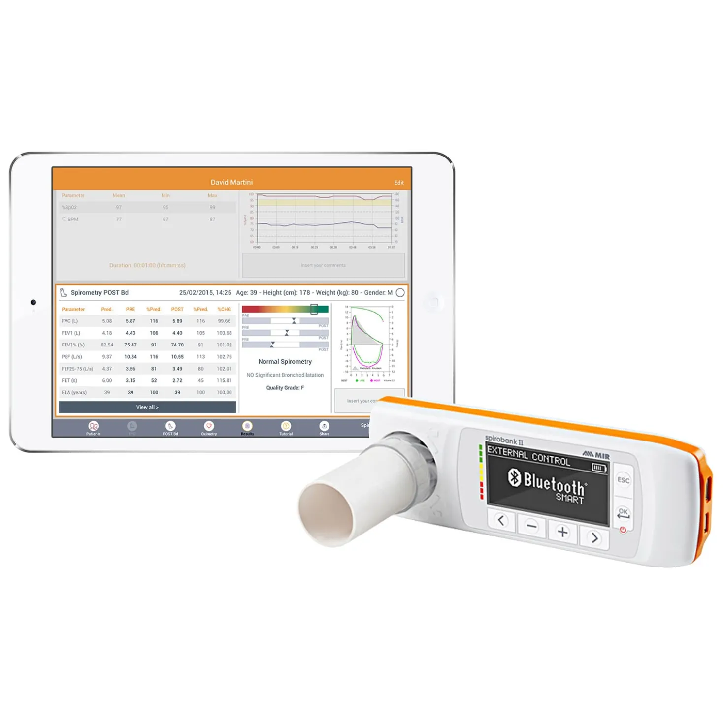 New Spirobank II Smart