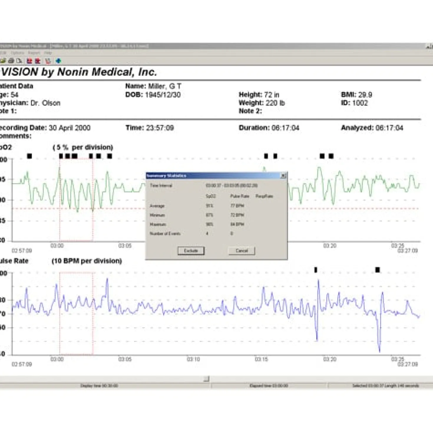nVISION Datenmanagement-Software