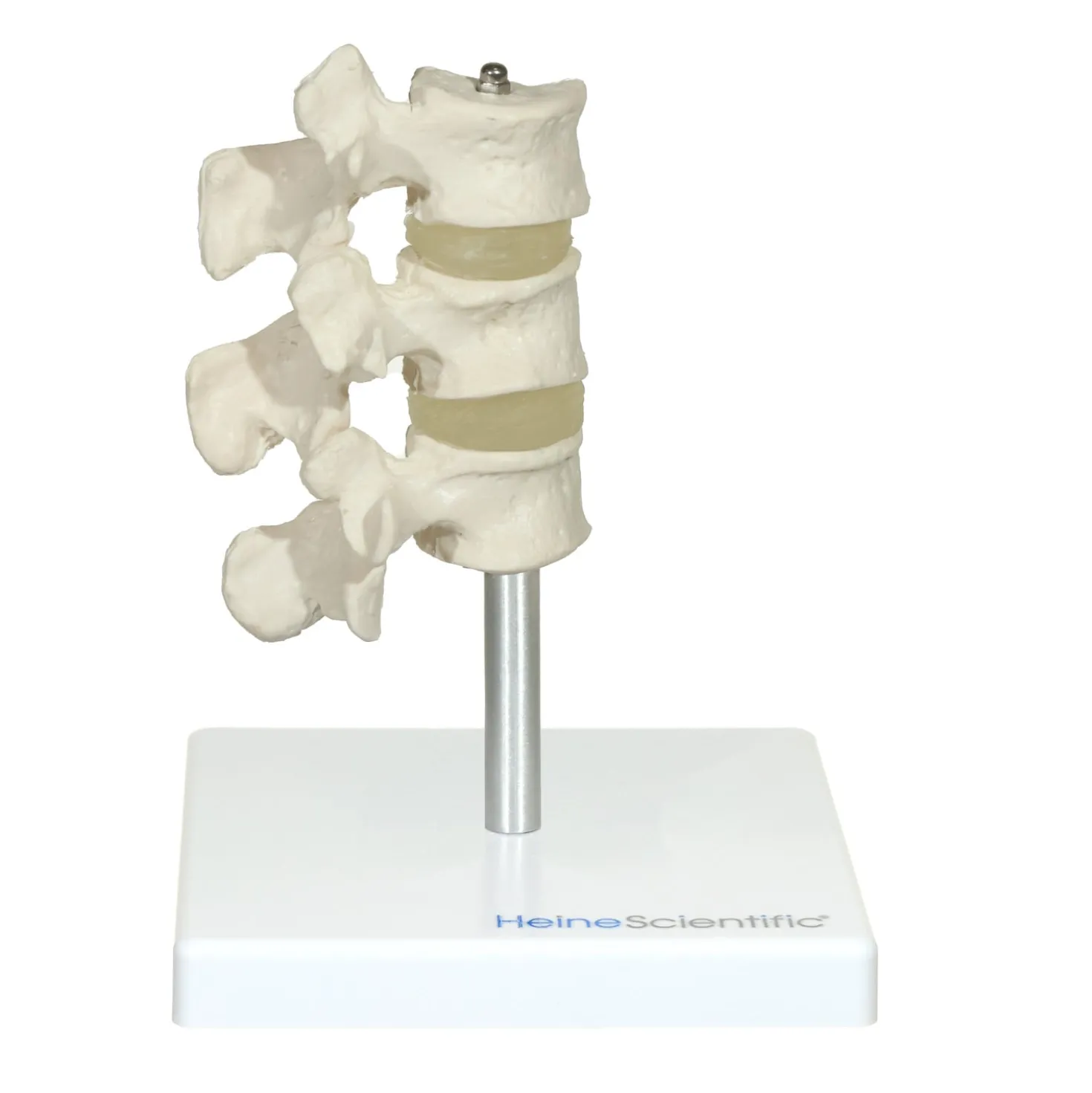 Osteoporose Modell