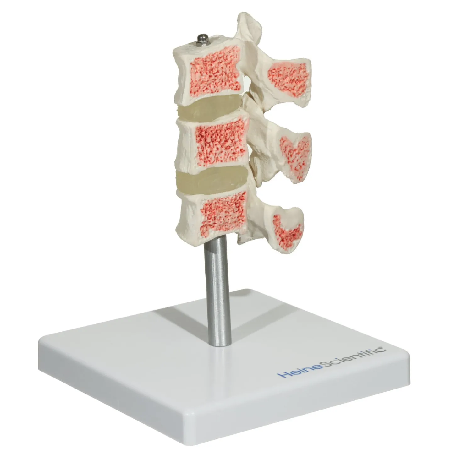 Osteoporose Modell