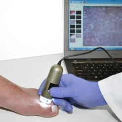 PodoScope
