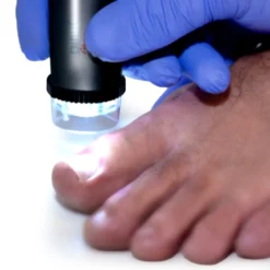 PodoScope