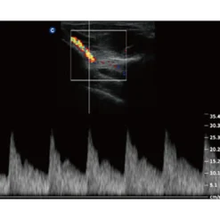 QBit5 Ultraschallgerät