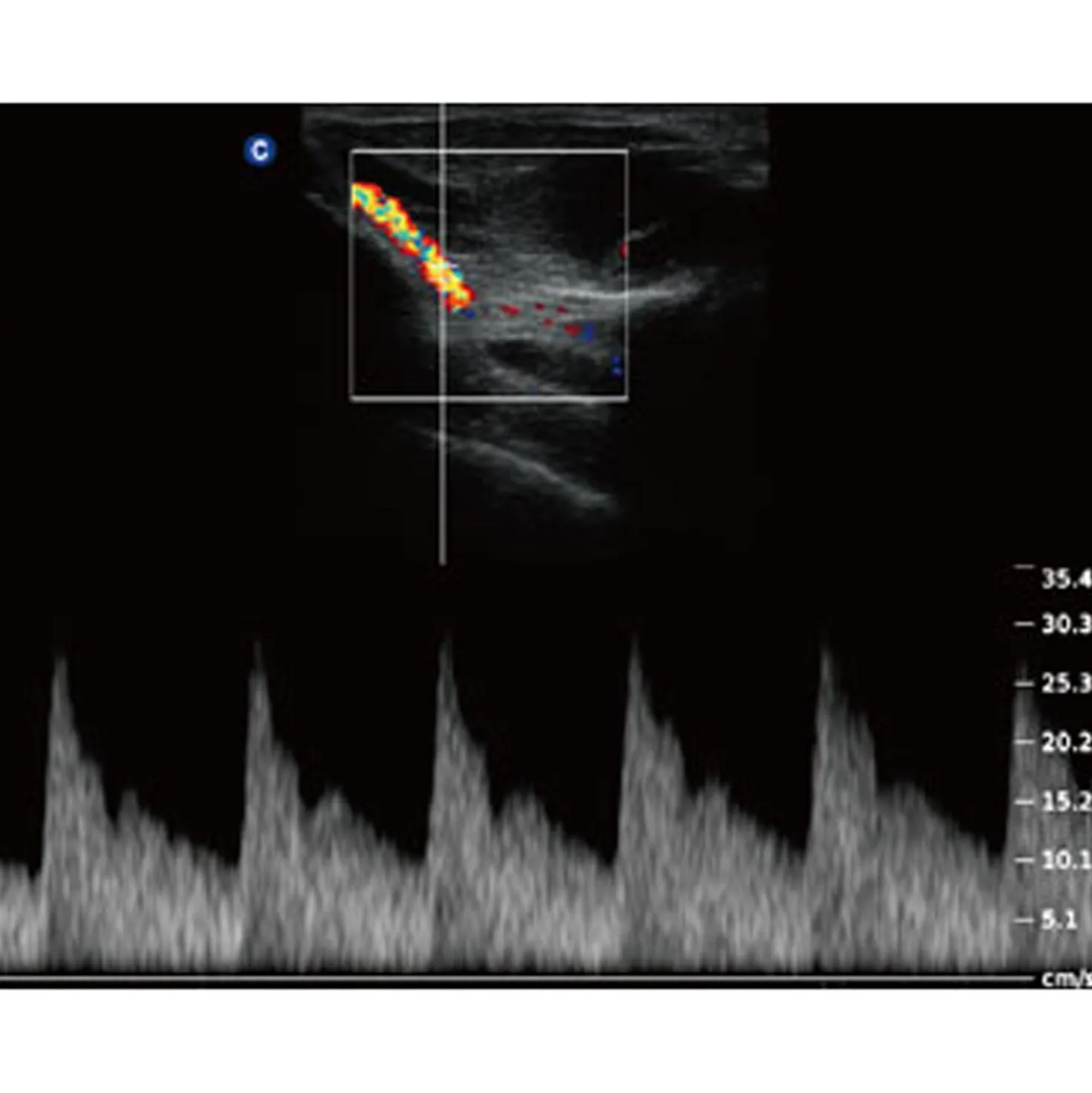 QBit5 Ultraschallgerät