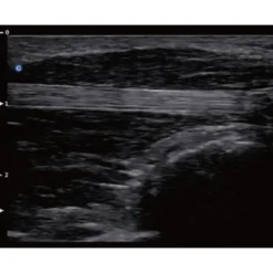 QBit5 Ultraschallgerät