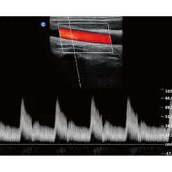 QBit5 Ultraschallgerät