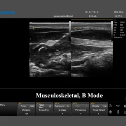 QBit 7 Ultraschallsystem