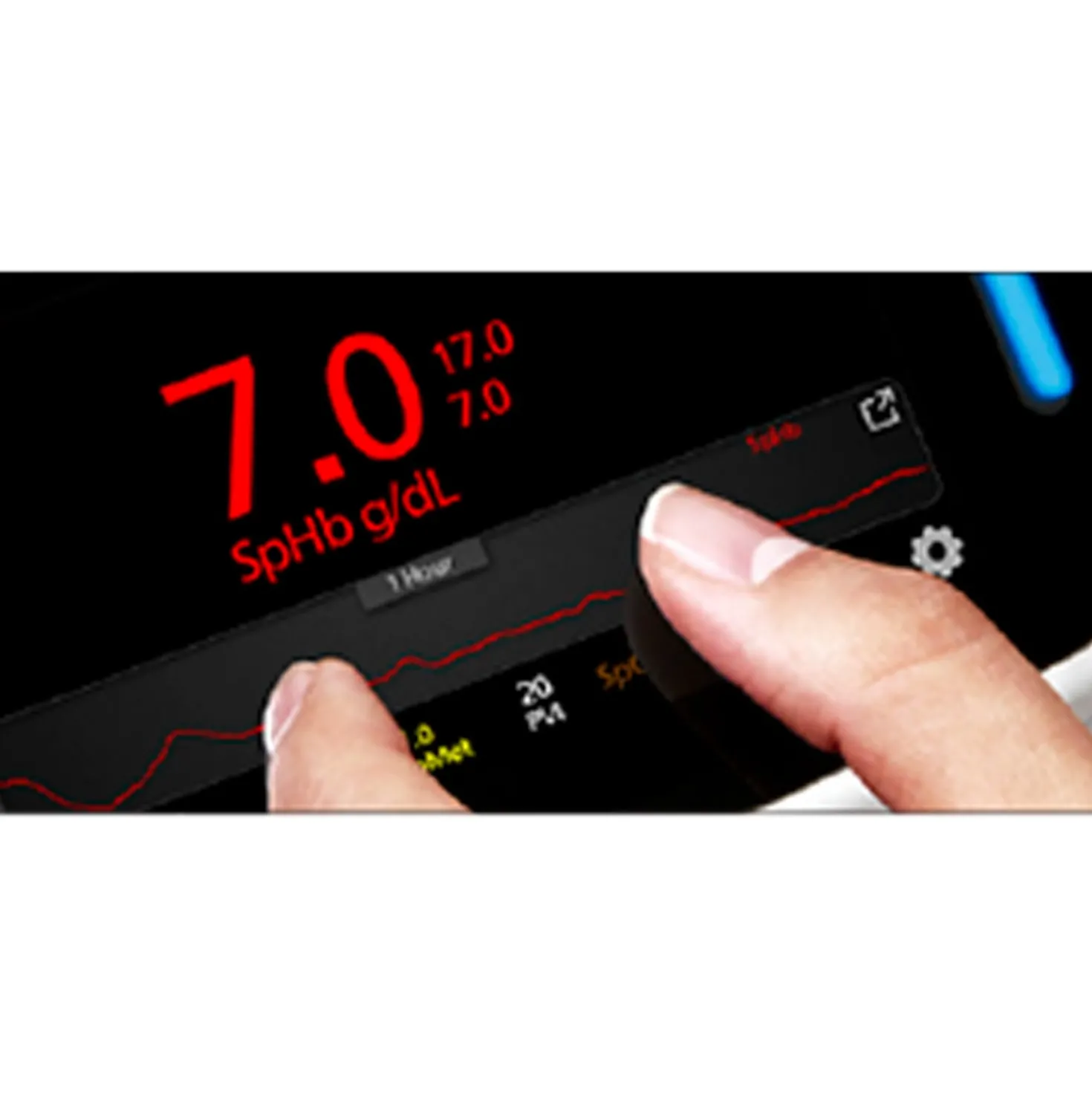 Radical-7® Pulse CO-Oximeter®