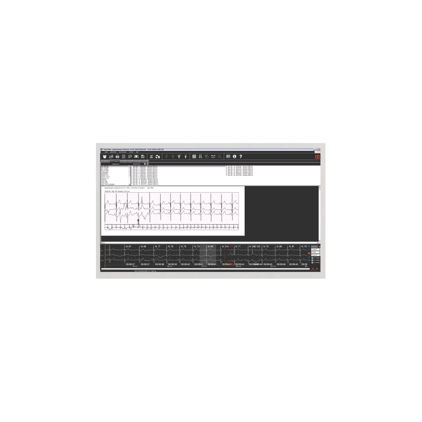 SmartHolter24 Holter-EKG-Gerät