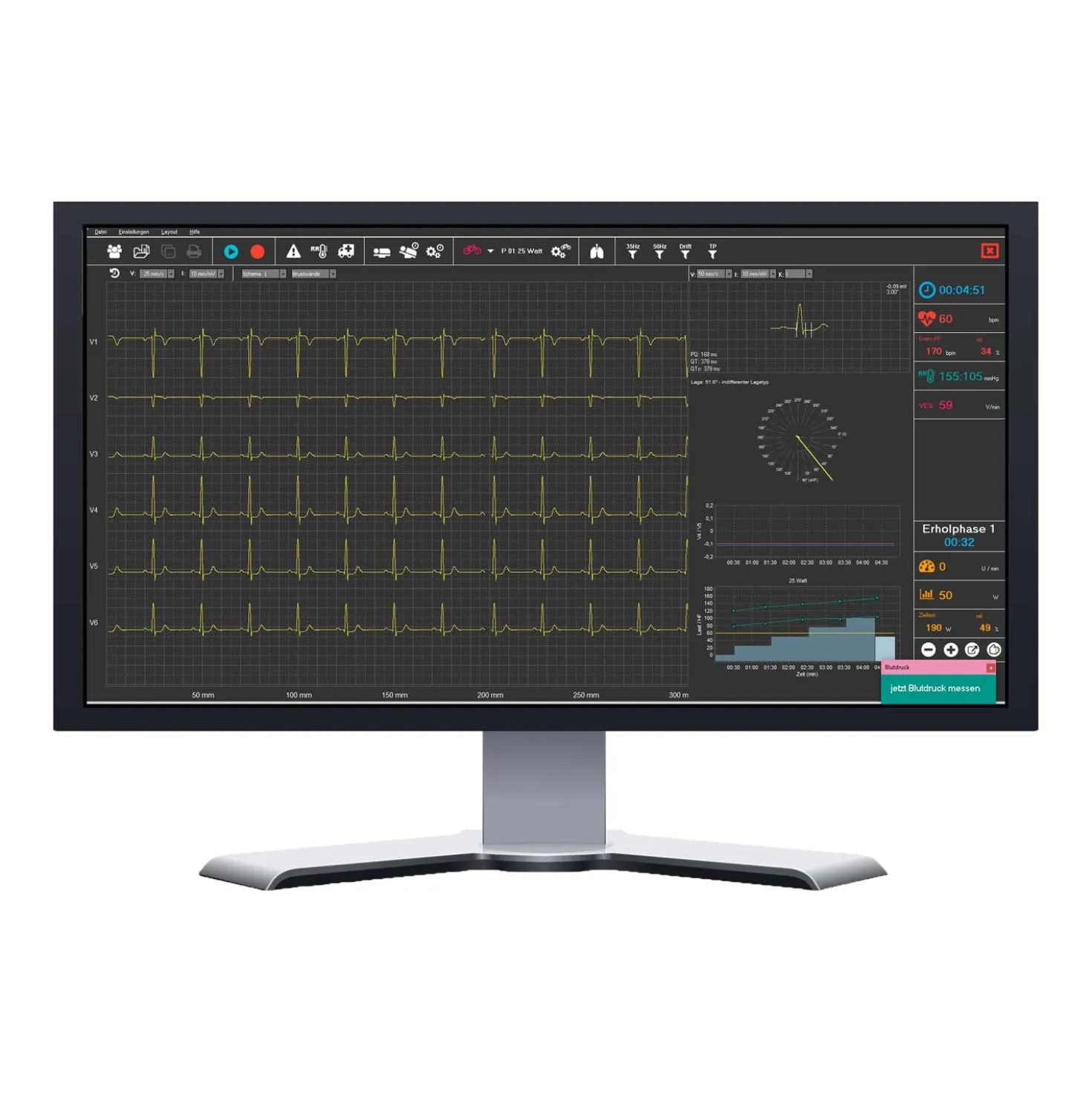 SmartScript Ergometrie