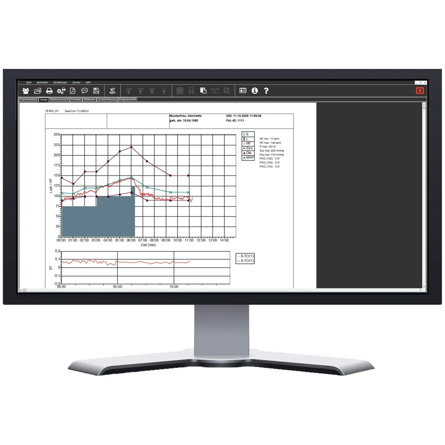 SmartScript Ergometrie