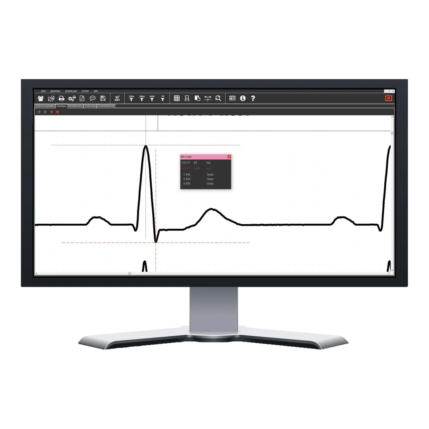 SmartScript PC-EKG-System