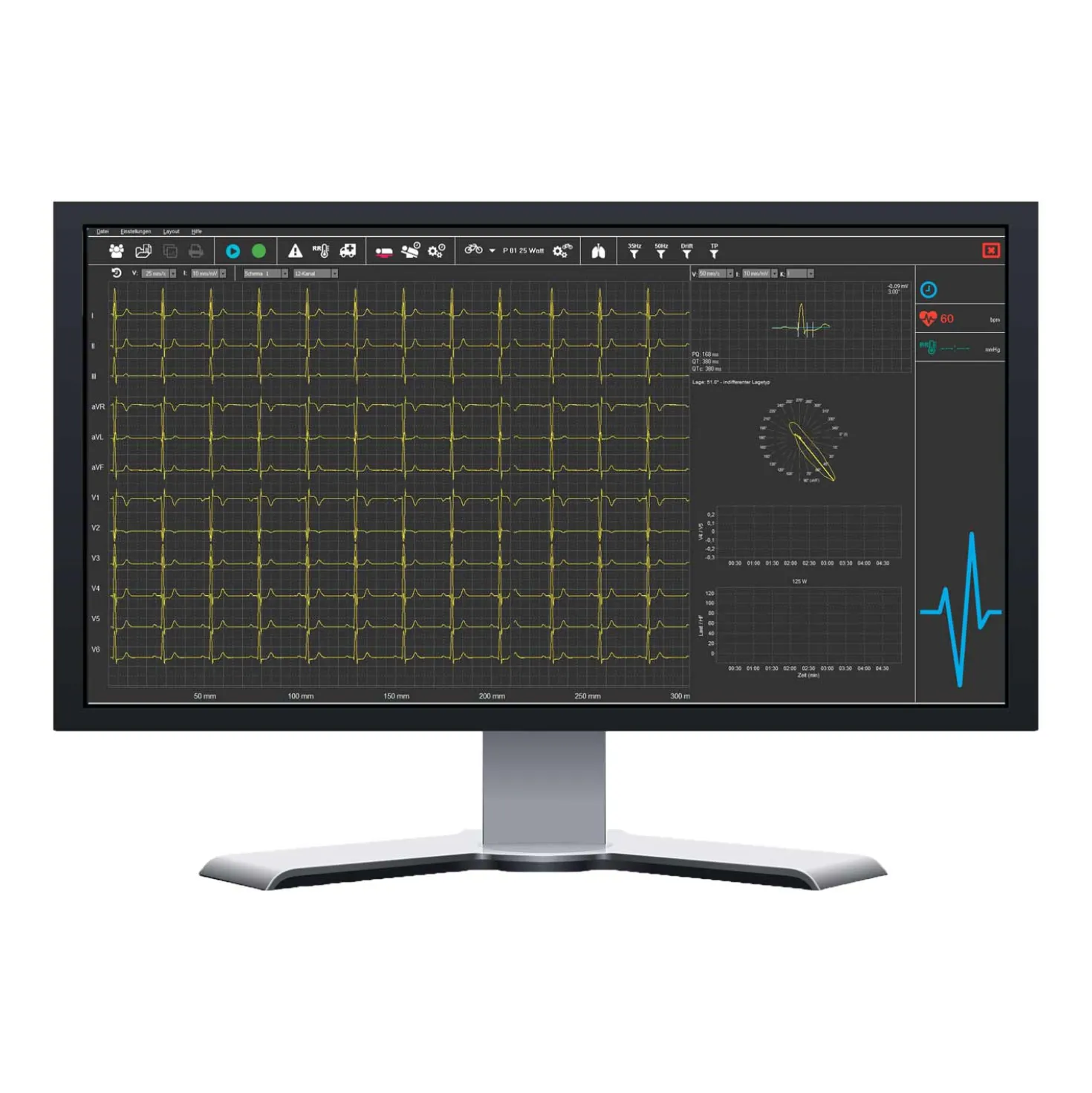 SmartScript PC-EKG-System