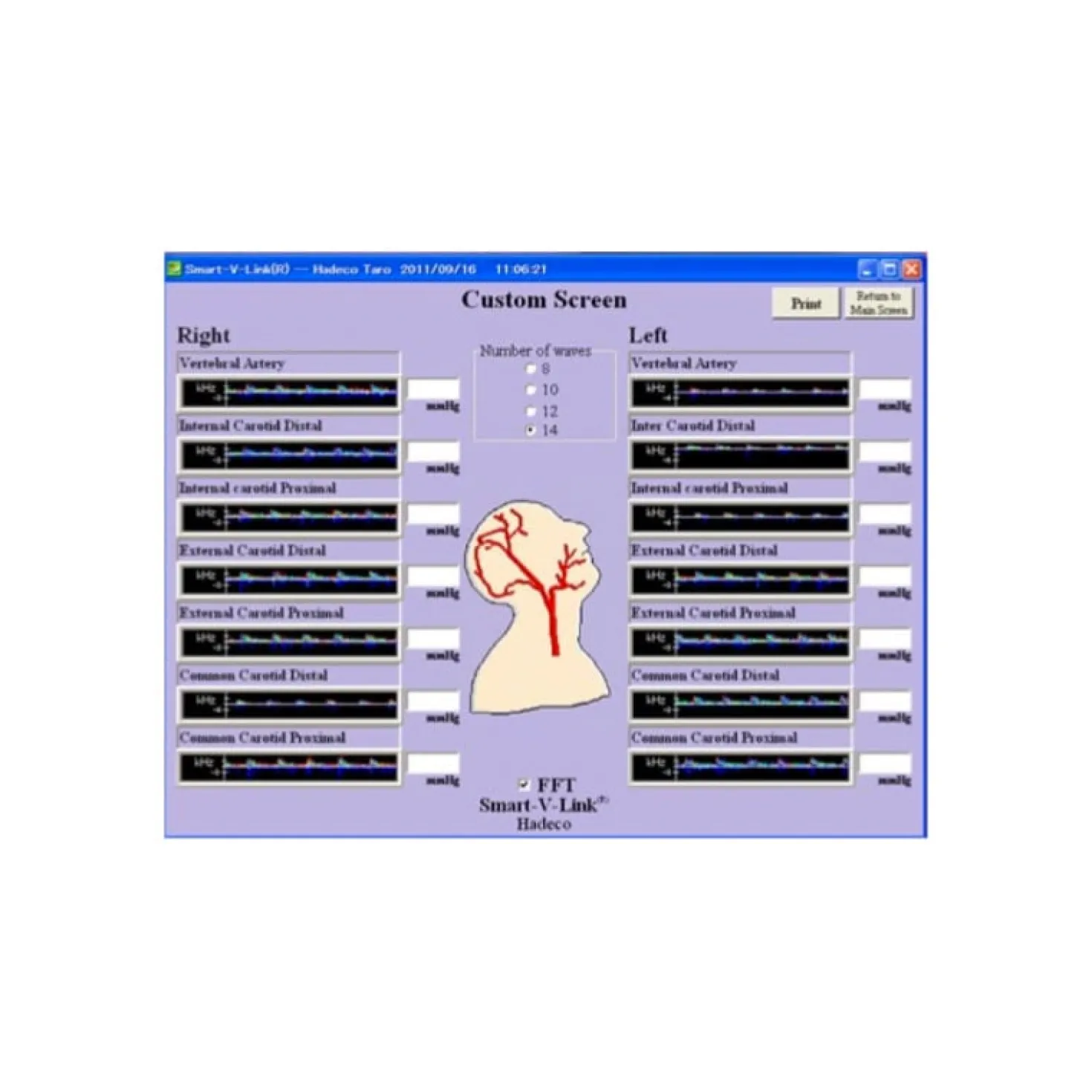 Smart-V-Link Software