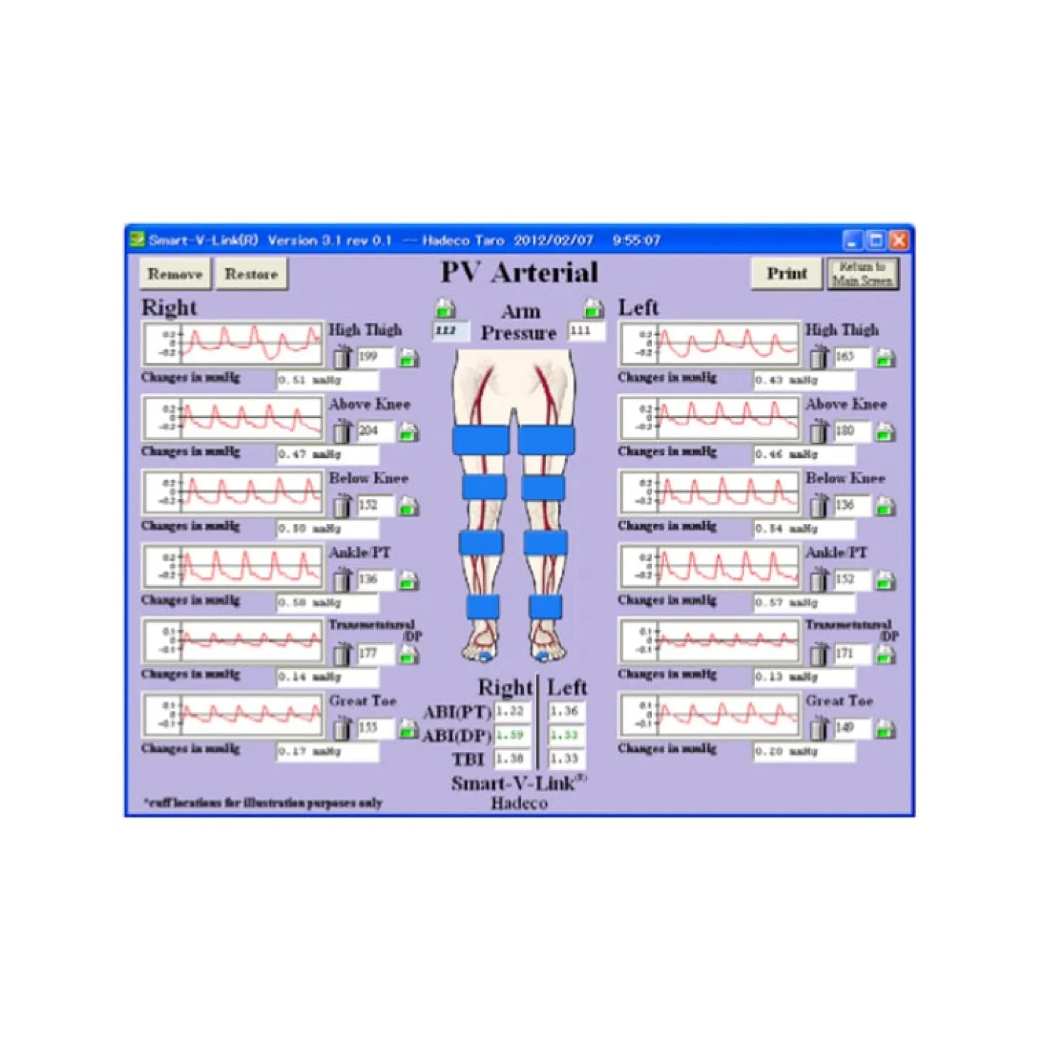 Smart-V-Link Software
