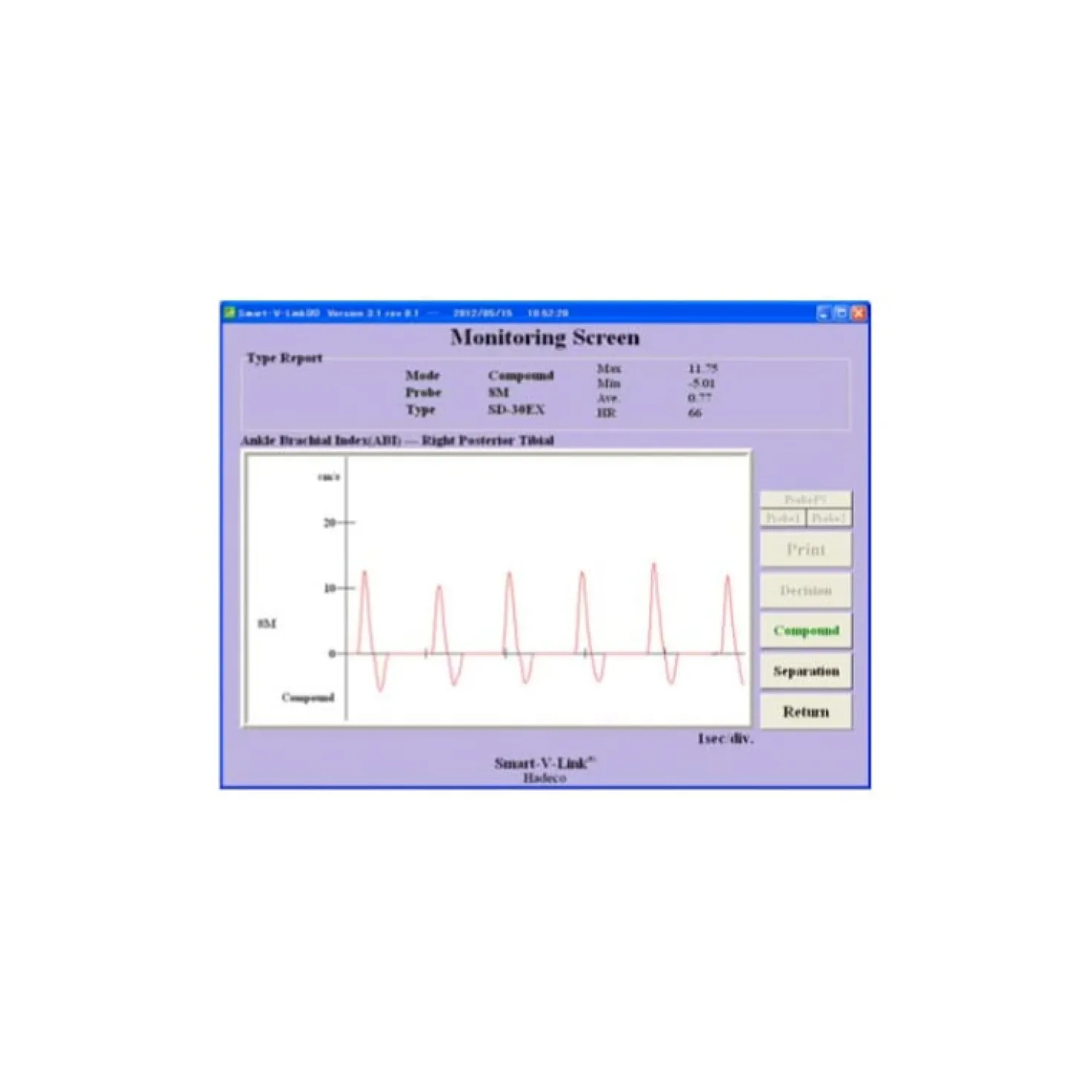 Smart-V-Link Software