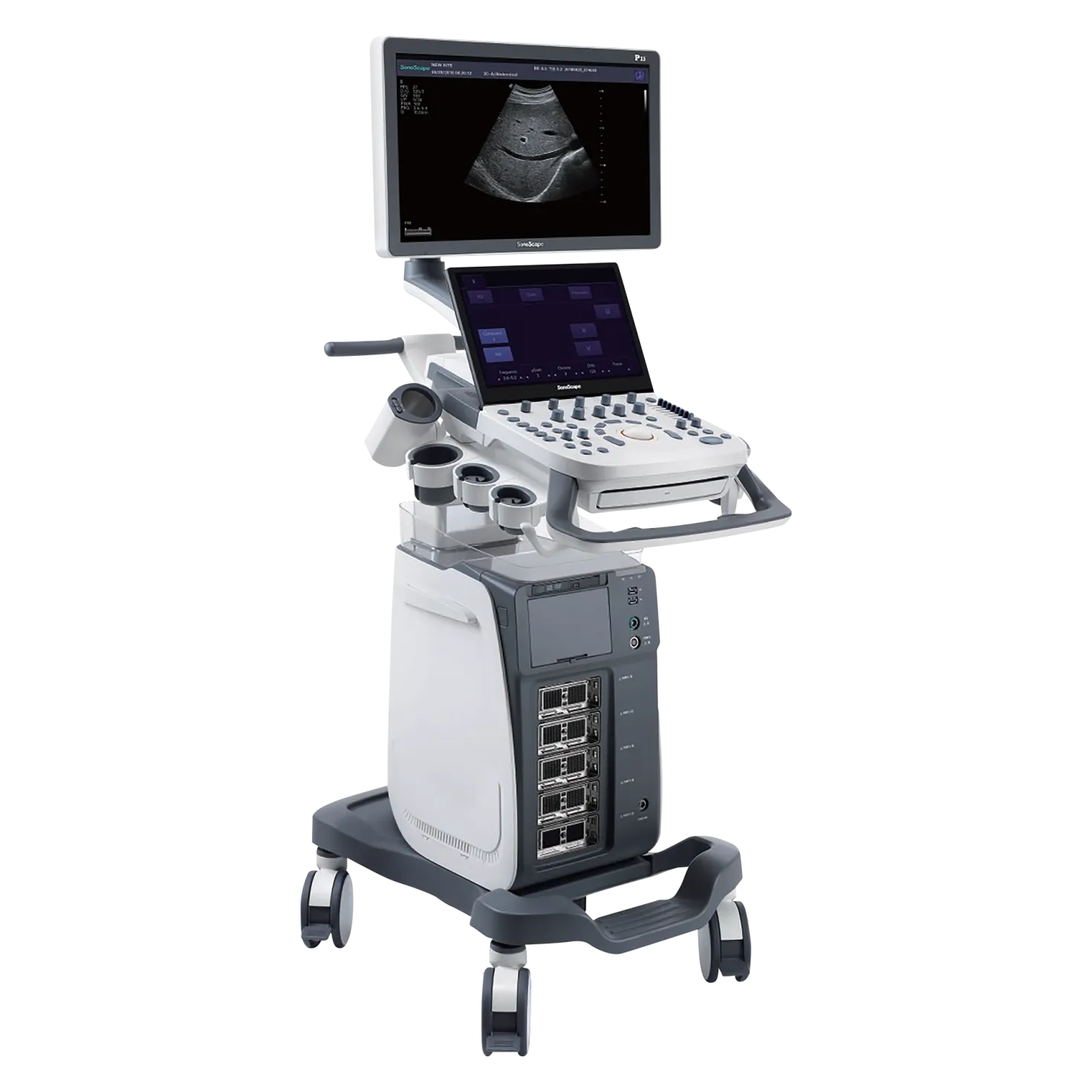 SonoScape P15 Ultraschallgerät