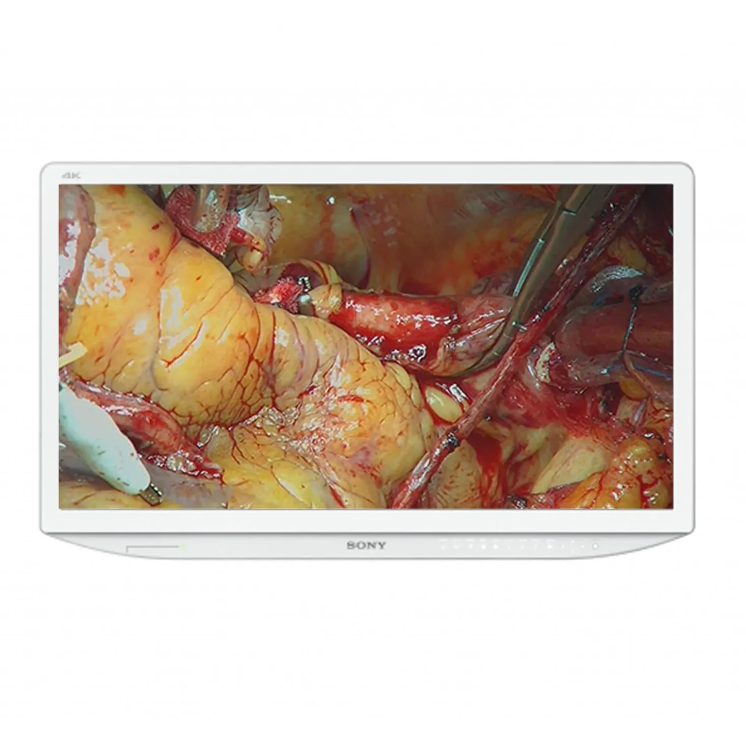 SONY LMD-X310MD