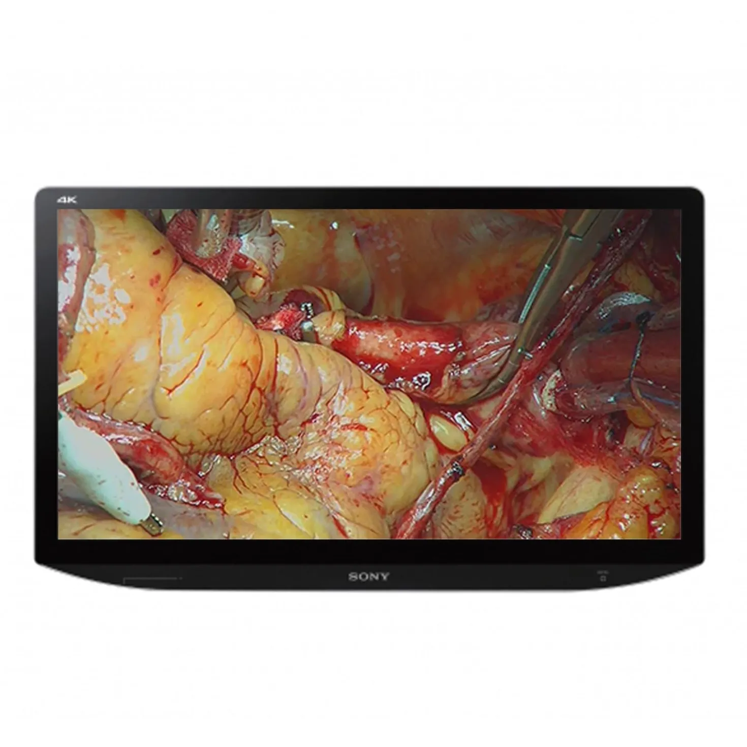 SONY Monitor