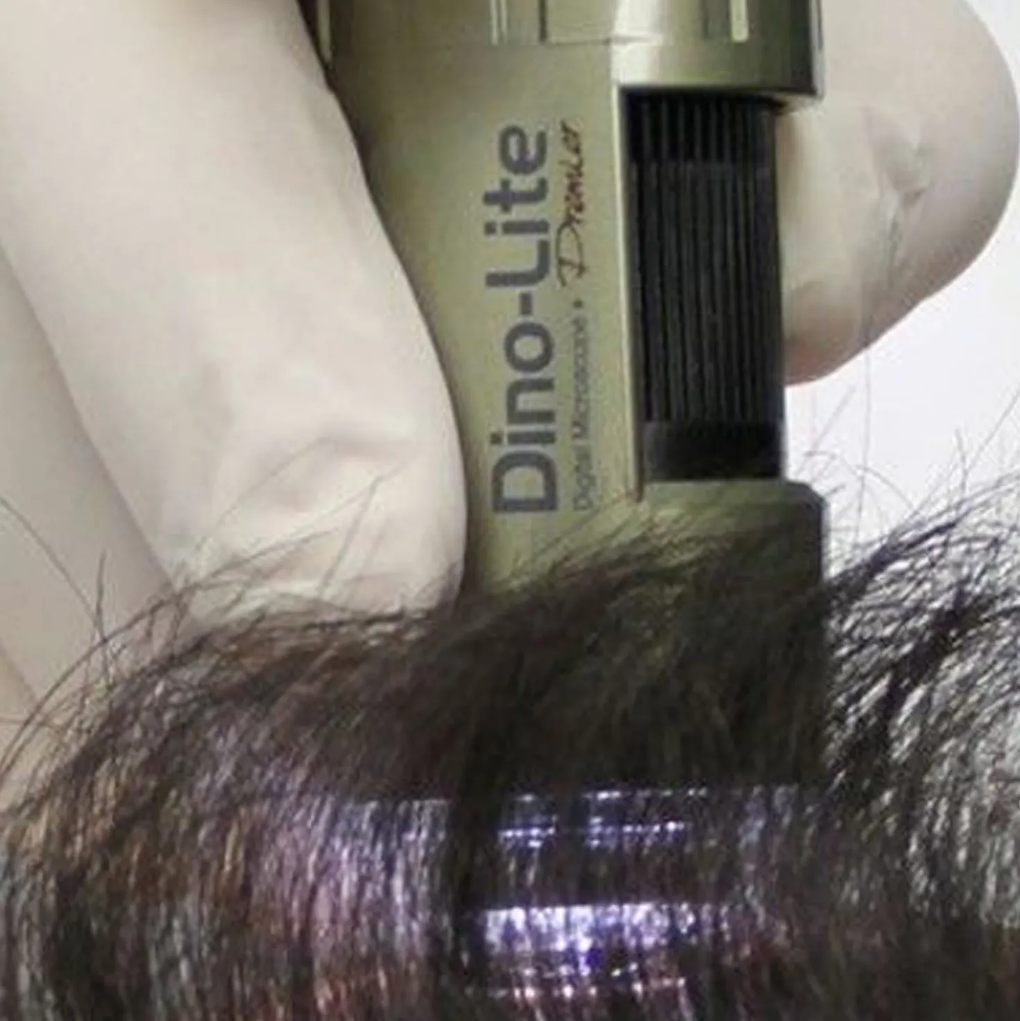 TrichoScope Polarizer