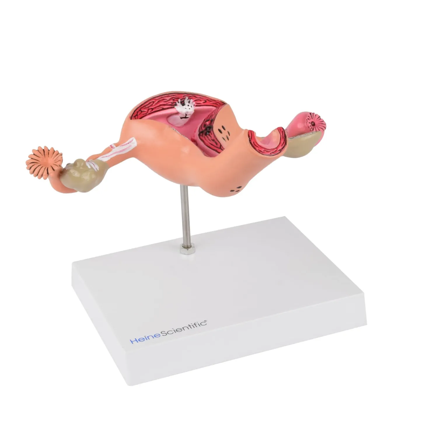 Uterus-Modell mit Erkrankungen