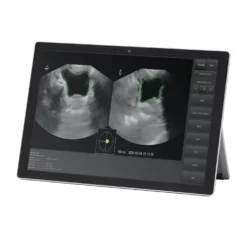 Vitascan LT Blasenscanner