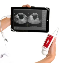 VitaScan v.2 Blasenscanner