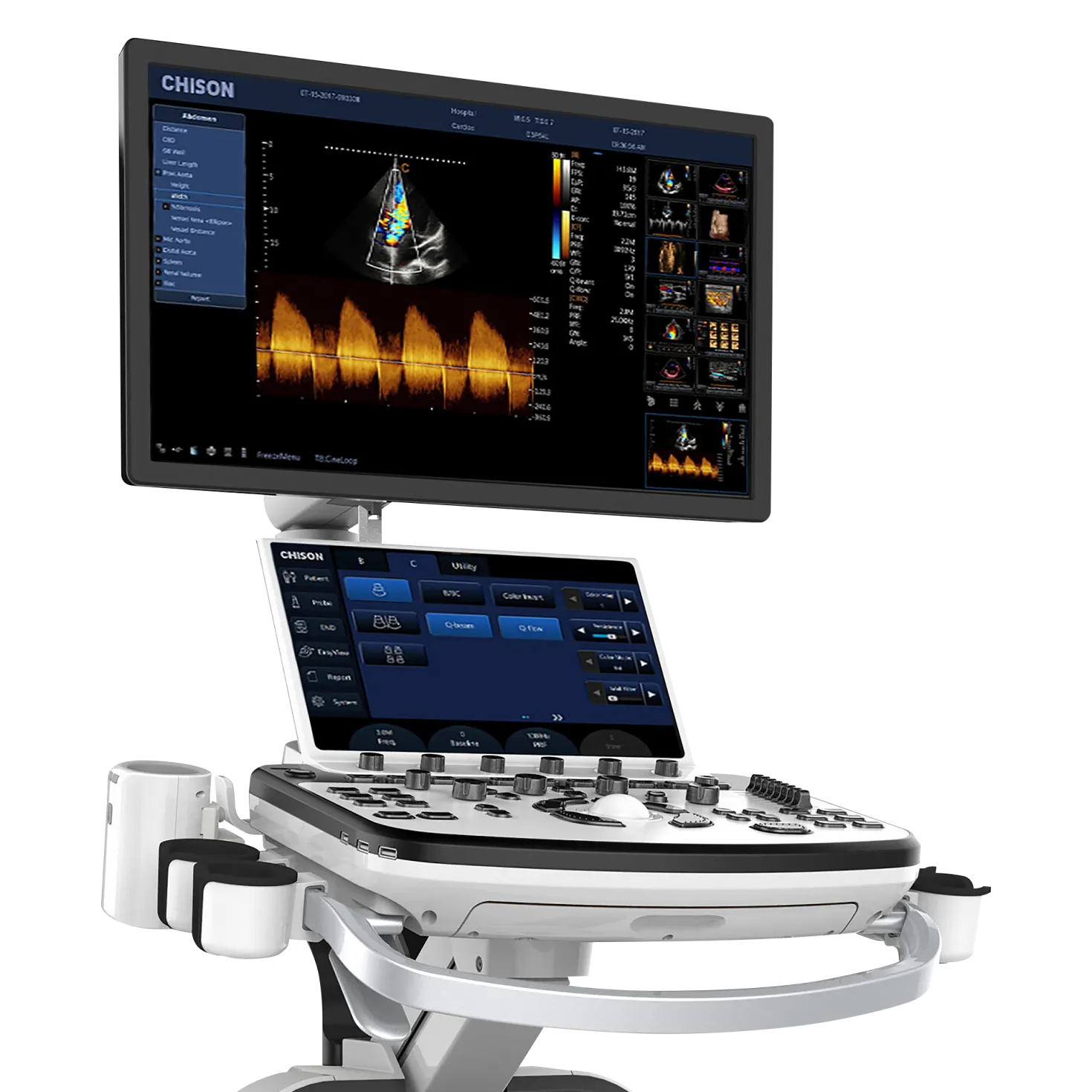 XBit 80 Farbdoppler-Ultraschall