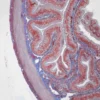 Zeiss Primostar 3 mit NCG-Objektiven